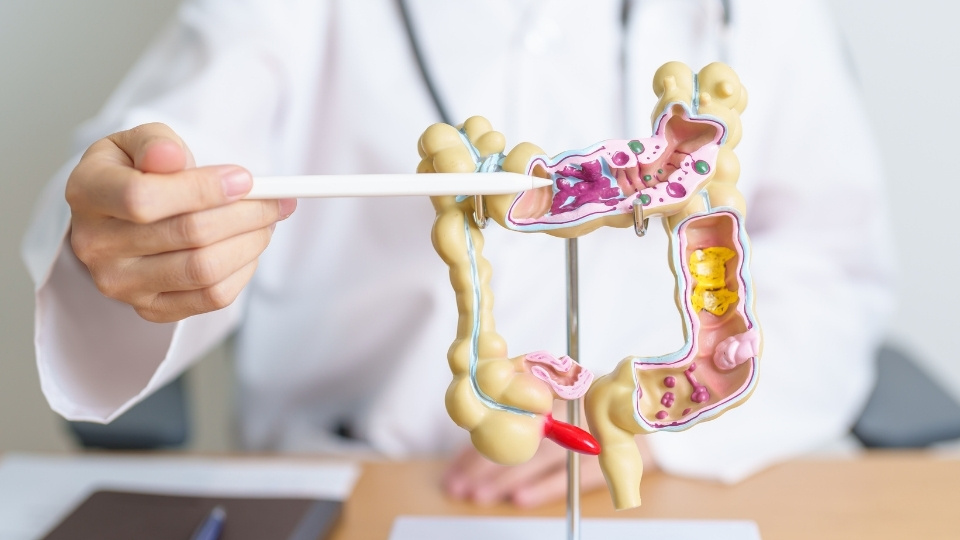 Diététiste-nutritionniste pointant un modèle du côlon humain, illustrant des parties du système digestif, y compris des zones avec des obstructions potentielles.