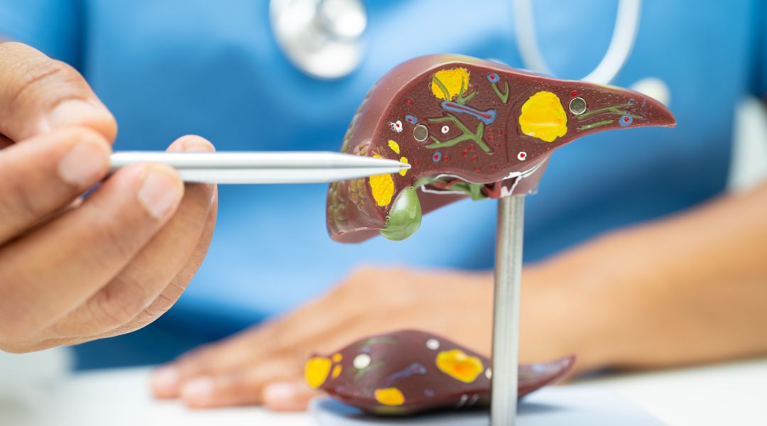 Prévenir et renverser la stéatose hépatique non alcoolique A doctor is using a stethoscope to examine a model of a liver.