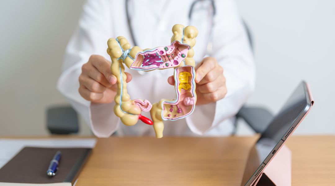 A person in a white coat holds up a model of the large intestine, showing its internal structure with different colored sections representing healthy and unhealthy tissue.