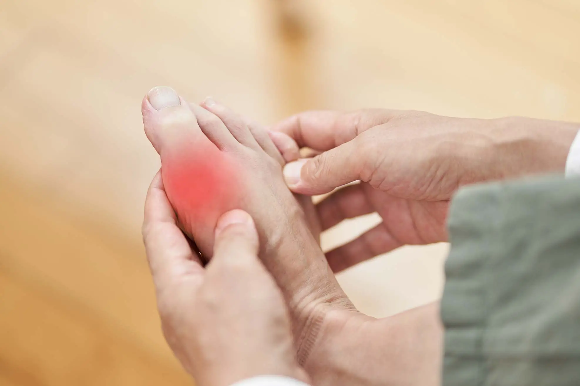 Pied avec goutte - Gout foot