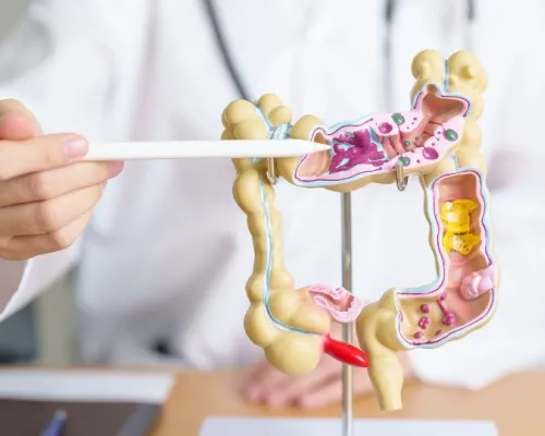 Diététiste-nutritionniste pointant un modèle du côlon humain, illustrant des parties du système digestif, y compris des zones avec des obstructions potentielles.