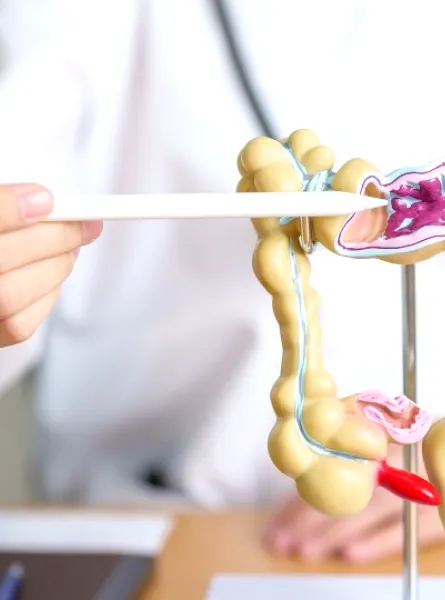 Diététiste-nutritionniste pointant un modèle du côlon humain, illustrant des parties du système digestif, y compris des zones avec des obstructions potentielles.