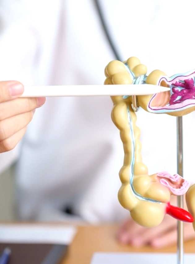 Diététiste-nutritionniste pointant un modèle du côlon humain, illustrant des parties du système digestif, y compris des zones avec des obstructions potentielles.