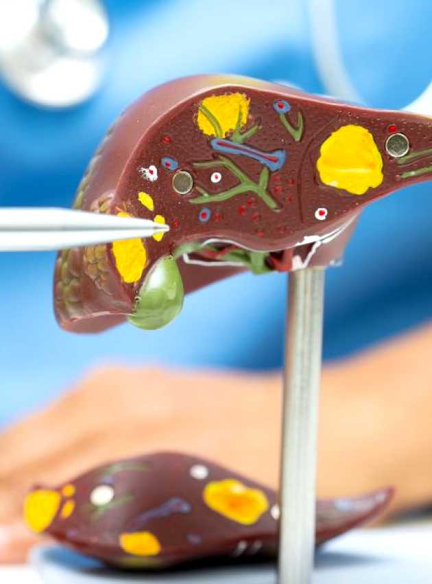 Prévenir et renverser la stéatose hépatique non alcoolique A doctor is using a stethoscope to examine a model of a liver.