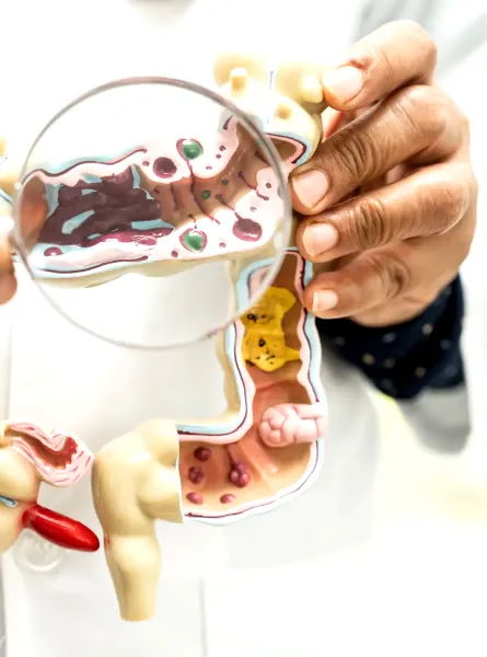 Médecin tenant une maquette du côlon avec loupe - Doctor holding a colon model with magnifying glass